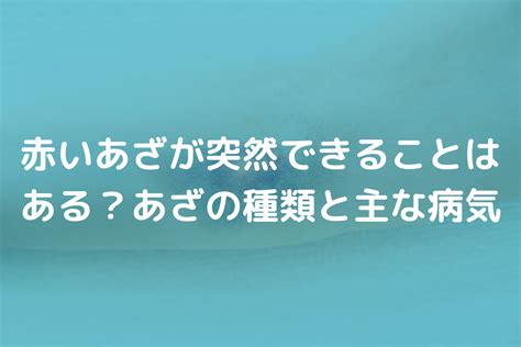 赤痣|あざの種類とは？あざの特徴と治療法を医師がわかり。